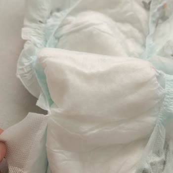 Ebebek Bantları Açarken Bezlerin İç Kısmı Hasar Görüyor Ve Kullanılamaz Hale Geliyor