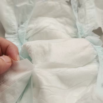 Ebebek Bantları Açarken Bezlerin İç Kısmı Hasar Görüyor Ve Kullanılamaz Hale Geliyor