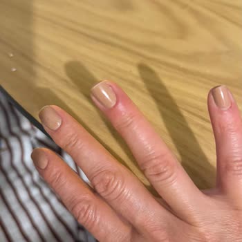 Masaj Ve Manikürde Hatalı Uygulama, Kesikler Ve İade Talebi