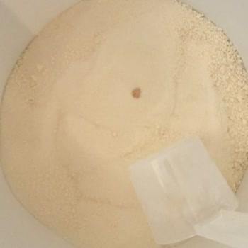 Bigjoy Kolajen Ürününde Yabancı Parça Ve Cevapsız İlgisizlik