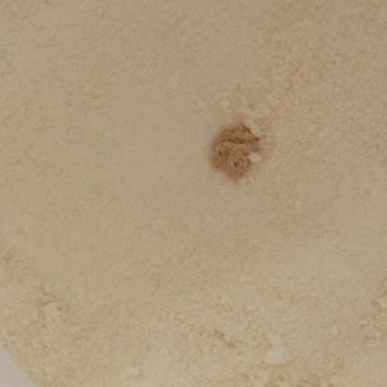 Bigjoy Kolajen Ürününde Yabancı Parça Ve Cevapsız İlgisizlik