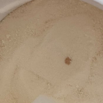 Bigjoy Kolajen Ürününde Yabancı Parça Ve Cevapsız İlgisizlik