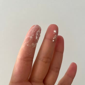 Rexona Deodorantın Pütürlü Formu Cilt Tahrişine Ve Performans Düşüklüğüne Neden Oluyor