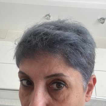 Saç Boyası Sarıyı Mavi Tonuna Çevirdi