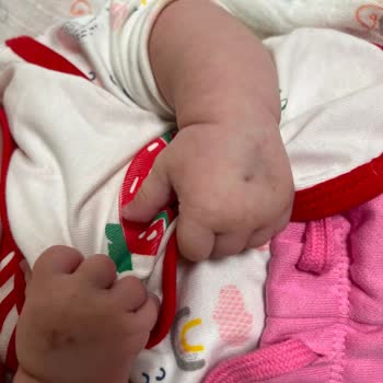 3 Aylık Bebeğime Gereksiz Kan Alımları Ve İhmalkar Tedavi