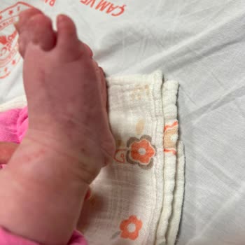 3 Aylık Bebeğime Gereksiz Kan Alımları Ve İhmalkar Tedavi
