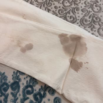 Lekeli Beyaz Jean Ve Çözüm Sağlanamayan Müşteri Hizmetleri