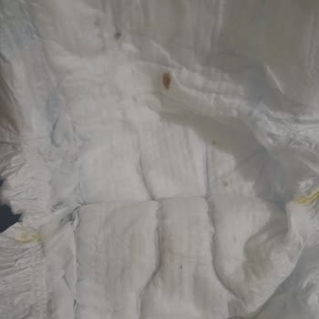 Molfix Premium 3 Numaralı Bebek Bezinde Kahverengi Ve Siyah Lekeler Beni Endişelendirdi