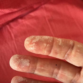 Dodospor Hepsiburada Ceketi Kimyasal Yanma ve Solunum Problemi Yaratıyor