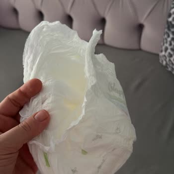 Migros'tan Alınan Sleepy Natural Bebek Bezlerinde Yırtık Sorunu Ve İade Talebi
