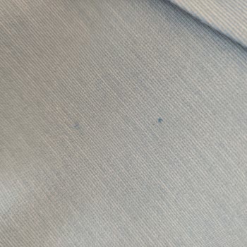 Kusurlu Ceket Değişim Sürecindeki Aksaklık Ve Müşteri Hizmetlerinin İlgisizliği