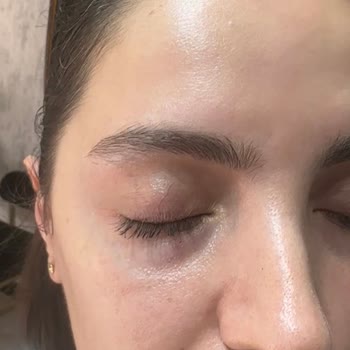 Op. Dr. Uğur Şahin Ameliyata Rağmen Şikayetlerimin Giderilmemiş Olması