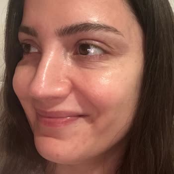 Op. Dr. Uğur Şahin Ameliyata Rağmen Şikayetlerimin Giderilmemiş Olması