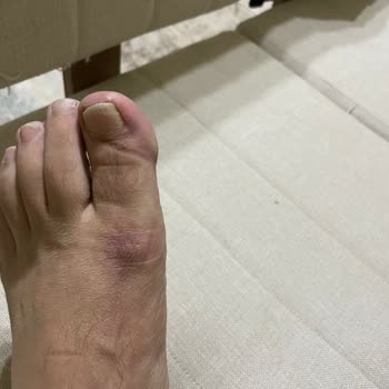 Nike TN Model Ayakkabının İç Dikişindeki Üretim Kusuru Ve Mağaza Tarafından Kullanım Hatası İddiası