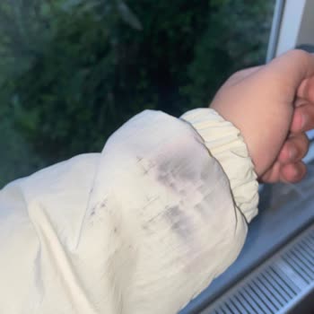 Ayıplı Ceket, Satıcının İade Reddine Ve Küfürlerine Karşı Shopier'den Çözüm Talebi