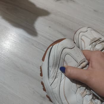 Skechers Ayakkabım Kısa Sürede Patladı, İade Talebim Reddedildi