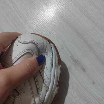 Skechers Ayakkabım Kısa Sürede Patladı, İade Talebim Reddedildi