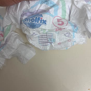 Molfix 5 Numaralı Bebek Bezinde Pamuk Yok, Güven Zedelenmesi