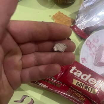 Tadelle Gofretten Gelen Yabancı Cisim Çocuğumu Boğaza Takıldı