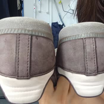 Adidas Samba Ayakkabısında Hızlı Renk Solması Ve Kalite Hayal Kırıklığı