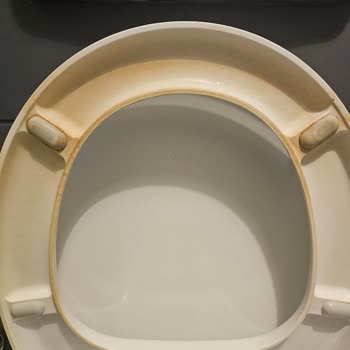 Vitra Klozet Kapağında Hızlı Sararma Ve Lekelenme Ürün Hatası