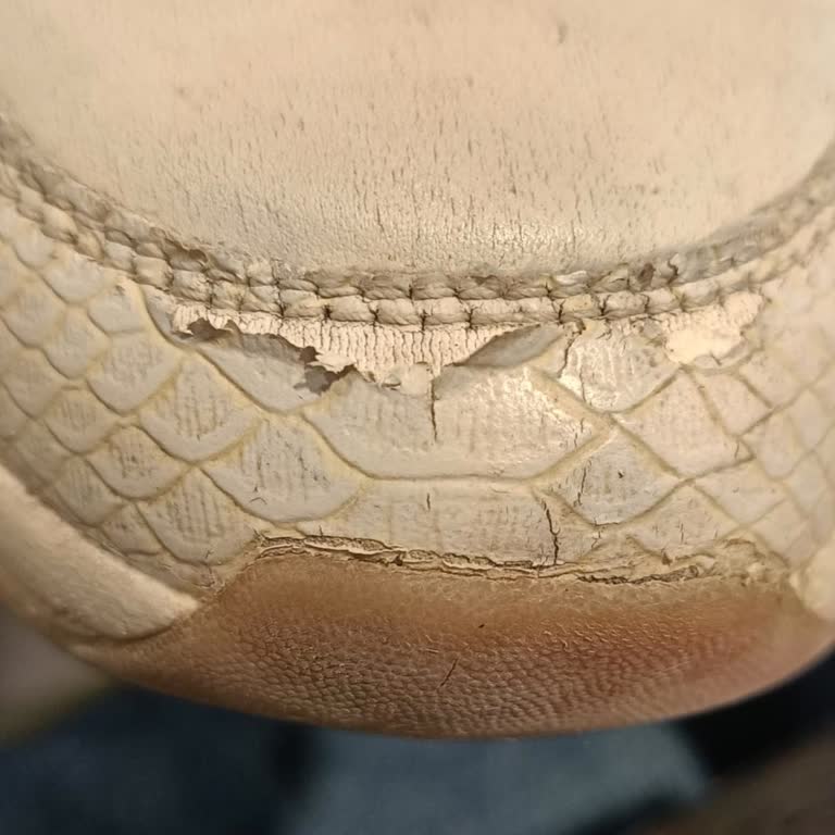 Derinin Kısa Sürede Soyulması Ve Skechers Müşteri Hizmetlerinden Olumsuz Yanıt