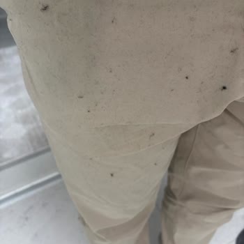 H&M Kapüşonlu Hırkada Tek Yıkamada Aşırı Tüy Dökülmesi Ve İade Talebi