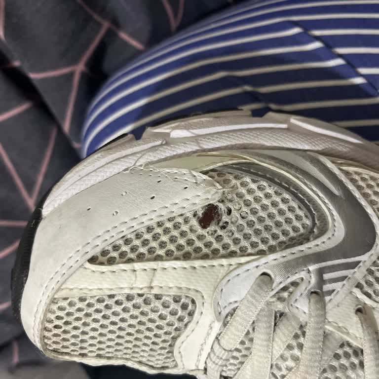 SuperStep’te Kısa Sürede Açılan New Balance 530 Ayakkabıda Kullanıcı Hatası İddiası Ve Mağduriyet