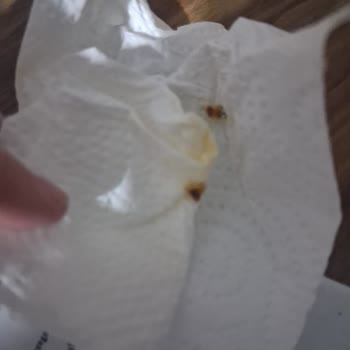 İndomie Noodle’dan Çıkan Kurt, Hijyen Ve Üretim Şartları Sorunları