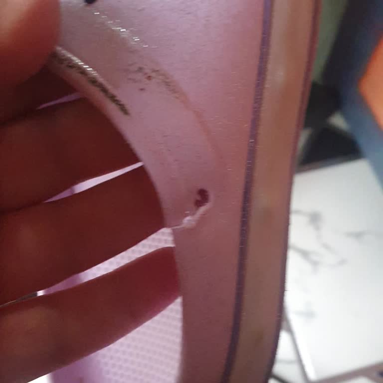 Çocuk Sandalet Terliğinin Kısa Sürede Kopması Ve Mağazanın Sorumluluk Reddi