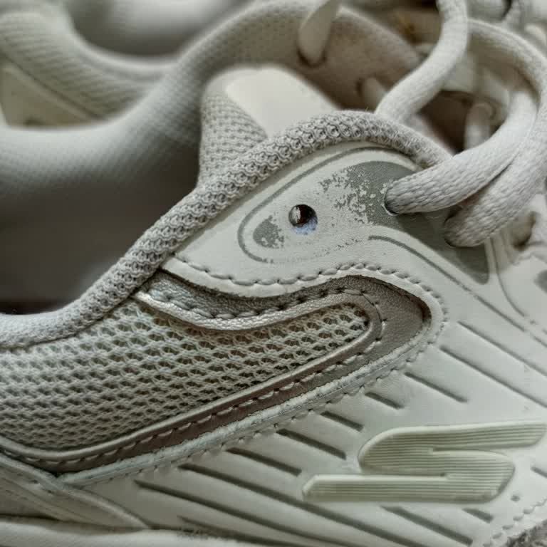 Skechers Ayakkabısında Erken Aşınma Ve Delik, Mağaza Kullanıcı Hatası İddiası