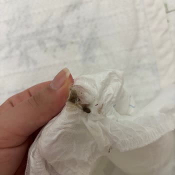 Molfix Premium Bebek Bezi İçinde Ölü Böcek Bulunması