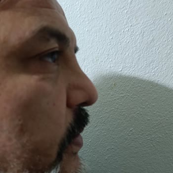 Burun Ameliyatı Sonrası Nefes Alamama Ve Estetik Bozuklukları