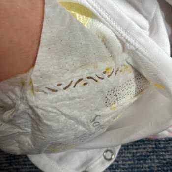 Prima Premium Care Bebek Bezinde Sürekli Sızdırma Ve Deri Tahrişi