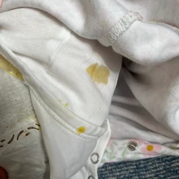 Prima Premium Care Bebek Bezinde Sürekli Sızdırma Ve Deri Tahrişi