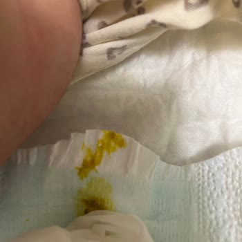 Prima Premium Care Bebek Bezinde Sürekli Sızdırma Ve Deri Tahrişi