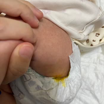 Prima Premium Care Bebek Bezinde Sürekli Sızdırma Ve Deri Tahrişi
