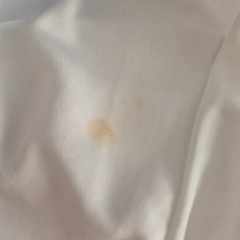 Gardrops Üzerinden Satın Alınan Kullanılmış Ve Kusurlu Elbise İade Süreci Çözülmedi
