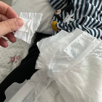 Cırt Cırt Bantları Kopuyor, Bebek Bezi Yerinde Durmuyor