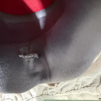 Skechers Ayakkabısında Topuk Kırılması Ve Yırtılma Üretim Hatası Reddedildi