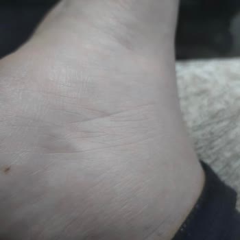 Tuzla Devlet Hastanesi’ndeki Doktorun Yüzeysel Muayenesi Ve Ultrason Talebinin Reddedilmesi