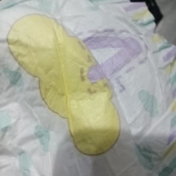Jenny & Willy Bebek Bezlerinde Sert Plastik Parçalar Tespit Edildi