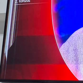 Kısa Sürede Ekran Arızası Ve Servis İletişim Sorunu Yaşayan Televizyon
