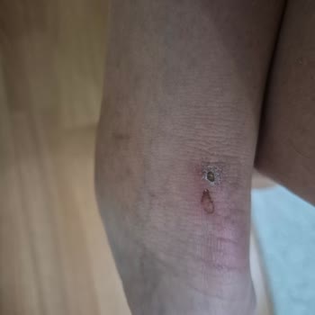 Ayıplı Terlik Ve Tekrarlanan Değişim Sorunu