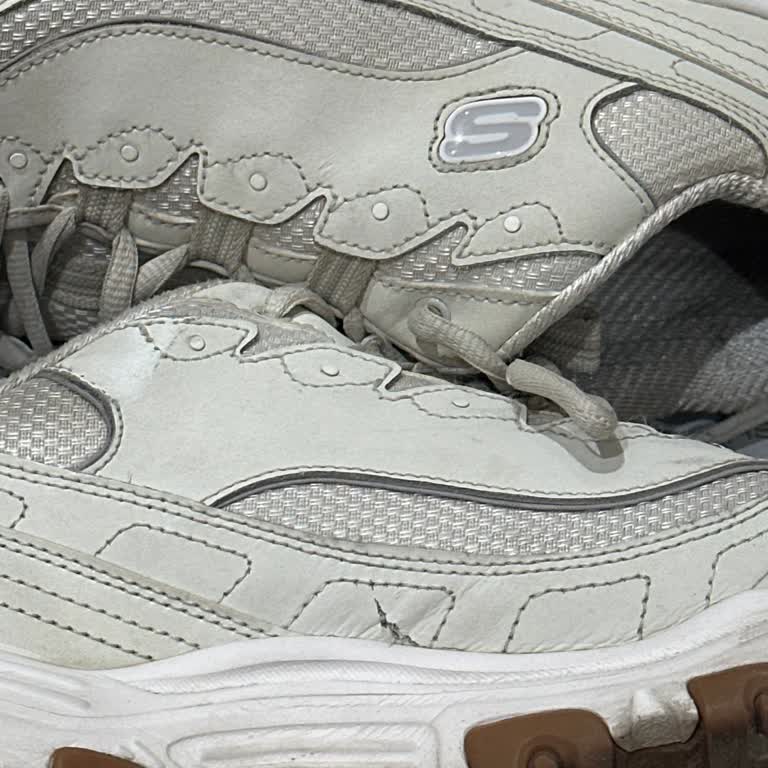 Skechers Ayakkabısının Deri Bölümü İki Ayda Yırtıldı, Garanti Kapsamı Reddiyle Mağdur Oldum