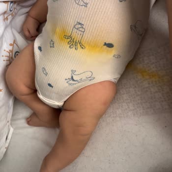 Molfix Bebek Bezlerinde Sürekli Sızıntı Ve Ücret İadesi Talebi