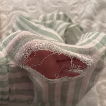 Hello Baby Kısa Tulumun Bir Saatte Yırtılması Ve Mağaza Desteği Eksikliği