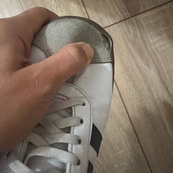 Adidas Ayakkabısında Altı Ayda Açılan Ön Kısım Ve İnceleme Reddedilmesi
