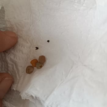 Hasata Sultani Yeşil Mercimek'te Böcek Sorunu