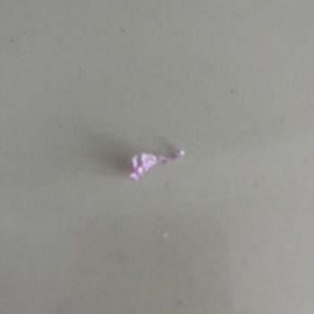İçinden Çıkan Mor Plastik Parça Güvenlik Endişesi Ve Şirketin Sessizliği